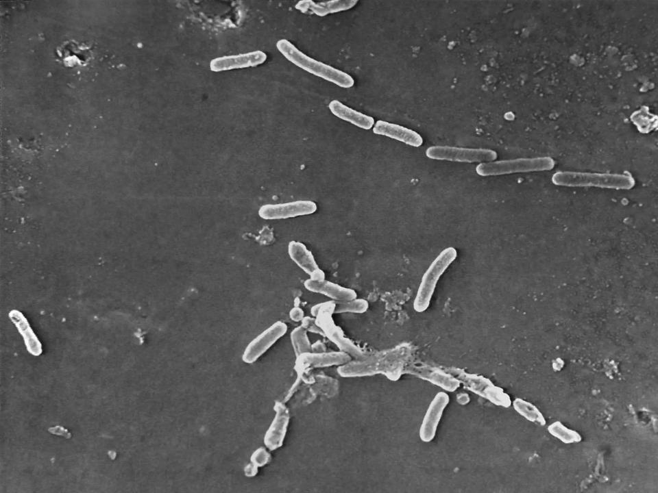 Resistente Bakterien haben in Augentropfen in den USA vier Todesopfer gefordert. - Copyright: Janice Haney Carr/CDC via AP
