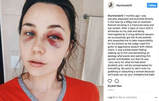 Ms Perrott posted this after her attacker received his conviction. Source: Instagram/ lillymiranda10