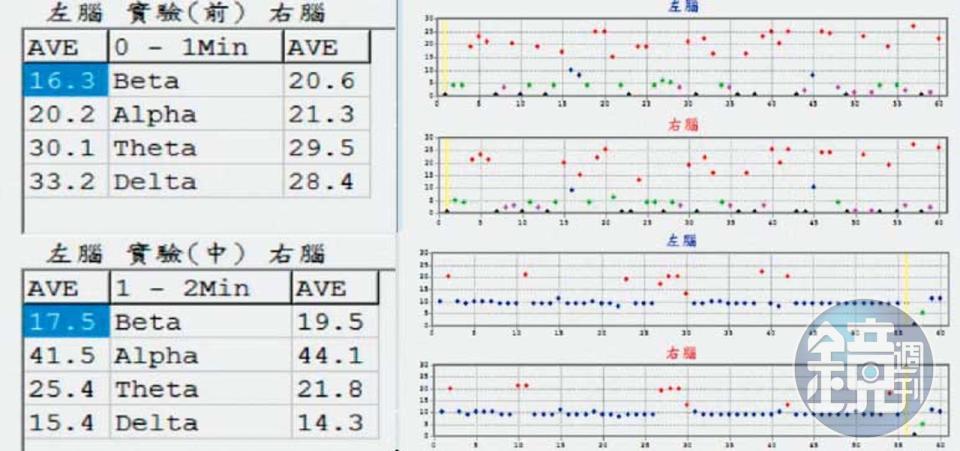 經10分鐘「調整」，業者秀出圖表告訴記者，「焦慮腦」的問題有明顯改善。