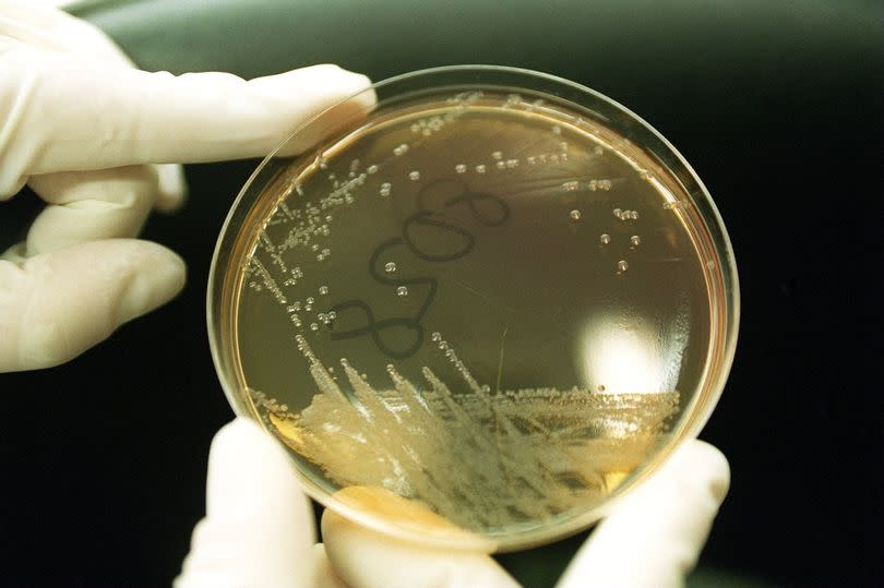 The outbreak of the shiga toxin-producing E.coli (STEC) is thought to have been caused by some supermarket sandwiches containing salad leaves.