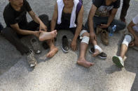 <p>Migrants rest their feet as they take a break from their protest march by the side of a road in the town of Indjija, some 24 miles northwest of Belgrade, Serbia, July 23, 2016. (Photo: Marko Drobnjakovic/AP)</p>