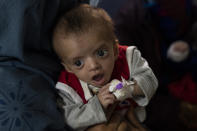 A mother holds her baby as he undergoes treatment at the malnutrition ward of the Ataturk National Children's Hospital in Kabul, Afghanistan, Thursday, Dec, 2, 2021. According to U.N. figures from early November, almost 24 million people in Afghanistan, around 60% percent of the population, suffer from acute hunger, including 8.7 million living in near famine. (AP Photo/Petros Giannakouris)