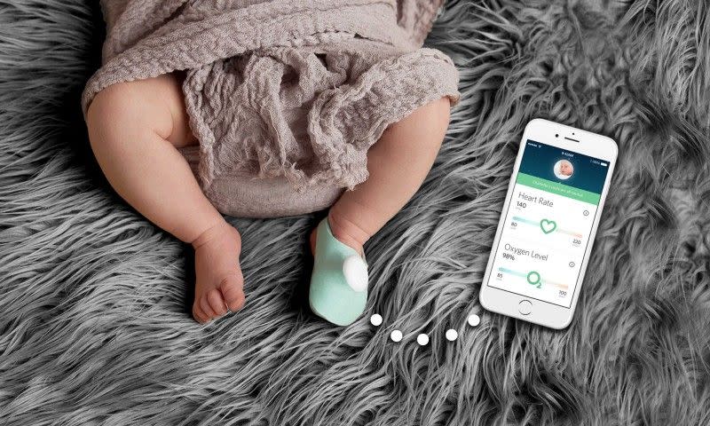 Der Owlet Baby-WLAN-Monitor galt 2016 als eines der am meisten hackbaren IoT-Geräte. (Foto: Owlet)