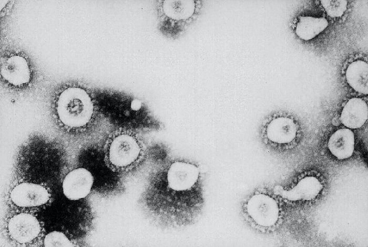 This undated handout photo from the Centers for Disease Control and Prevention (CDC) shows a microscopic view of the Coronavirus at the CDC in Atlanta, Georgia: CDC/Getty Images