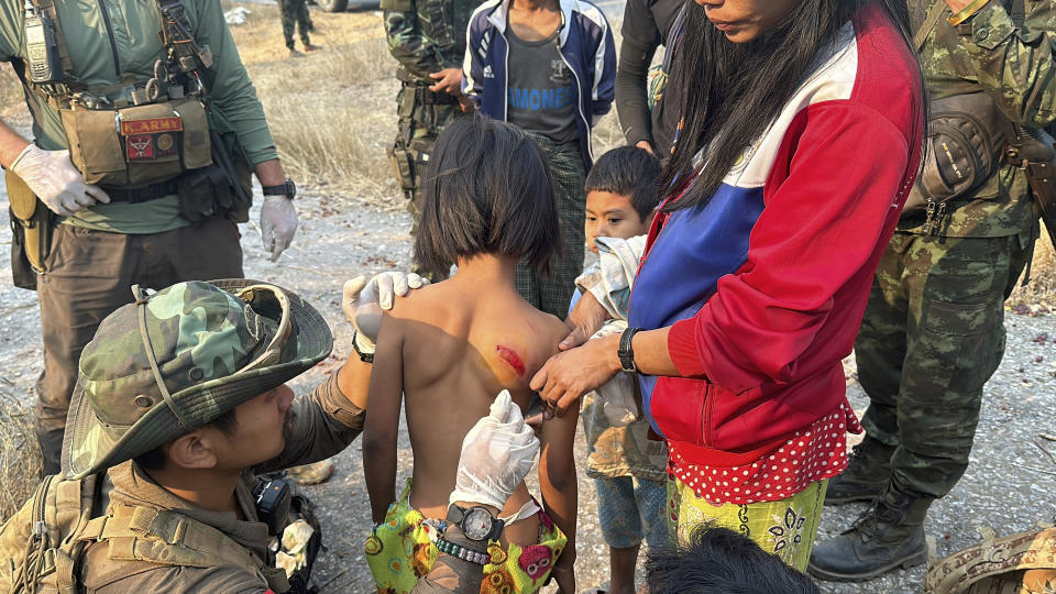 In this photo released by the Free Burma Rangers, a child is seen wounded by Burma military in Pasaung, Karenni state, Myanmar on March 1, 2024. (Free Burma Rangers via AP)