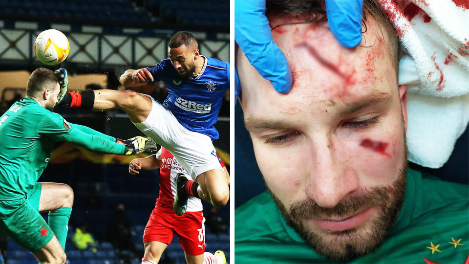 Kemar Roofe kicking Ondrej Kolar in the head (pictured left), and the head cuts from the kick on Kolar (pictured right).