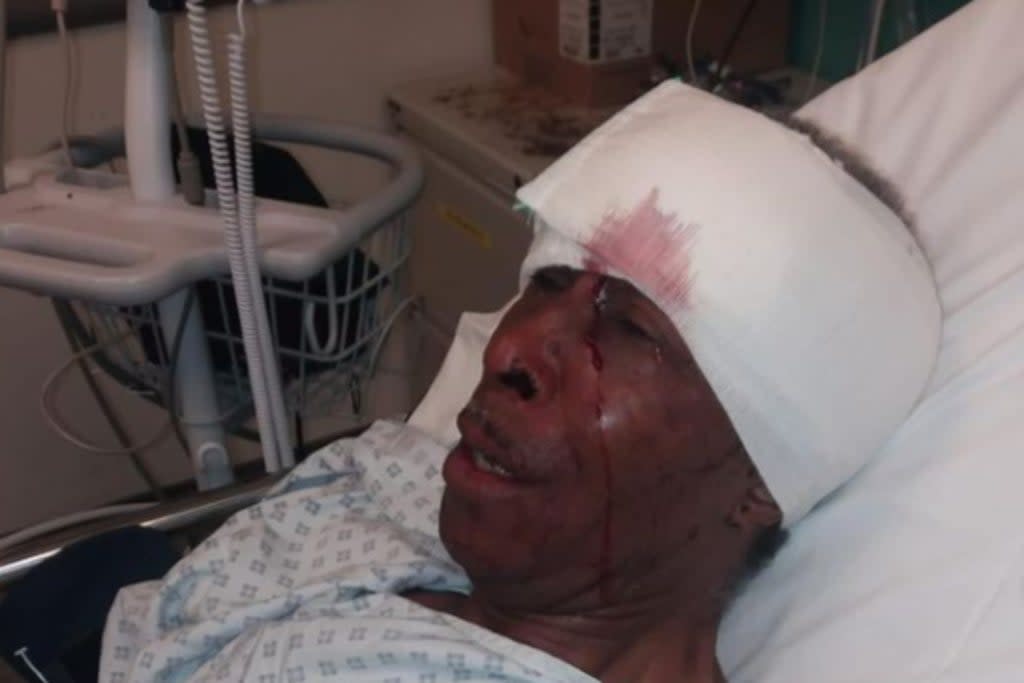 His daughter posted a picture of her dad, 70, in hospital after the arrest  (@picturecharx)