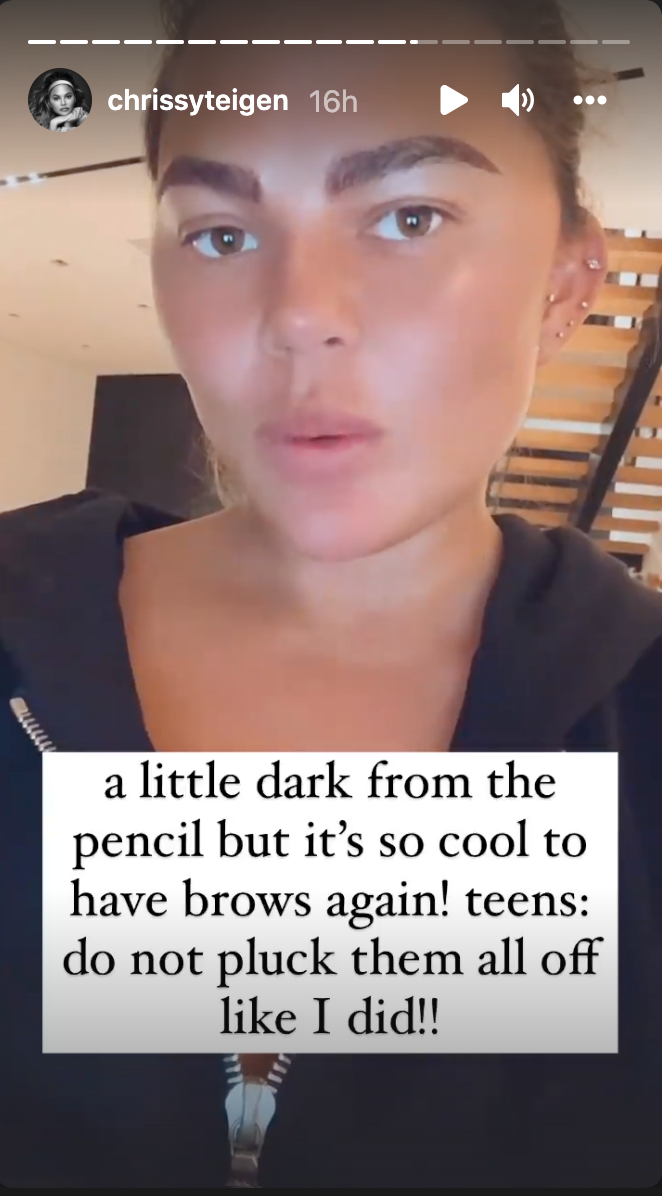 Teigen blamed overplucking for damaging her own brows. (Photo: Instagram/Chrissy Teigen)