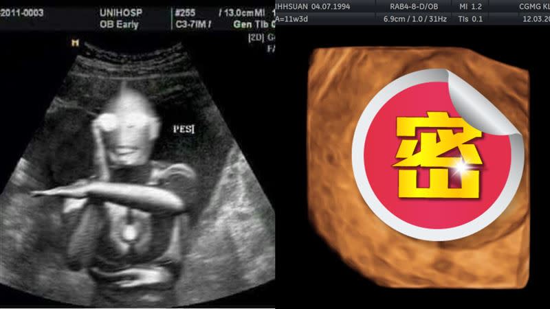 一名準媽媽分享寶貝孩子的超音波，看起來宛如鹹蛋超人。（圖／翻攝自爆怨公社）