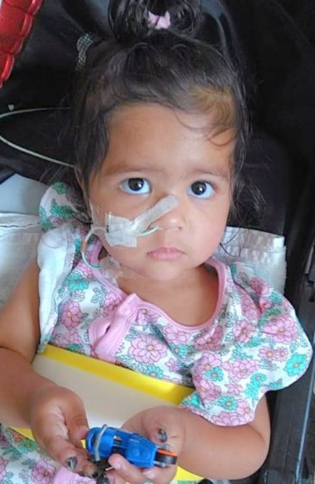 Gursirat with her feeding tube in while recovering from necrosis on her fingertips and other complications. Picture: Supplied