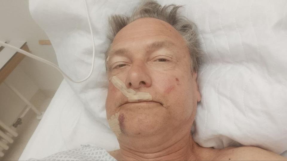 Stab victim Michael Stürzenberger posted a selfie from his hospital bed (Facebook)