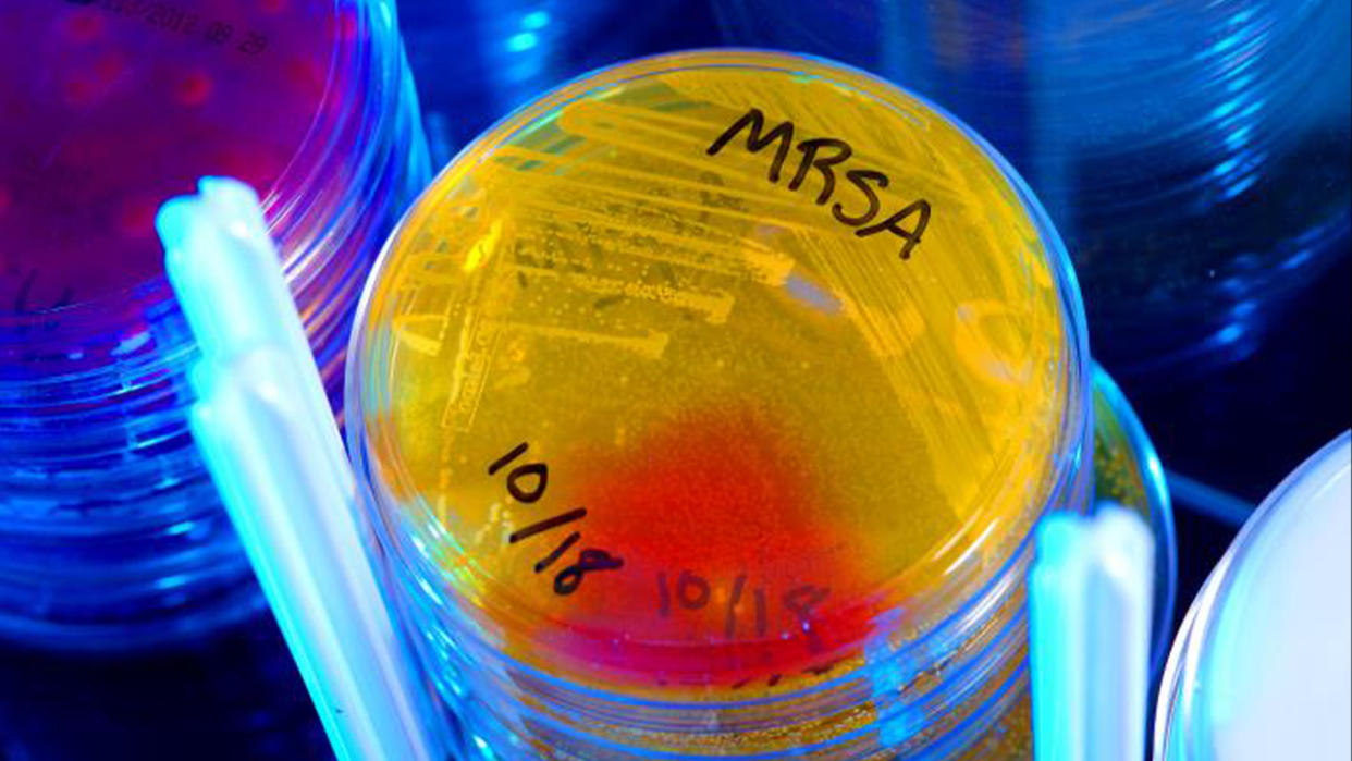  A petri dish of a bacterium called MRSA glowing yellow under a black light. 