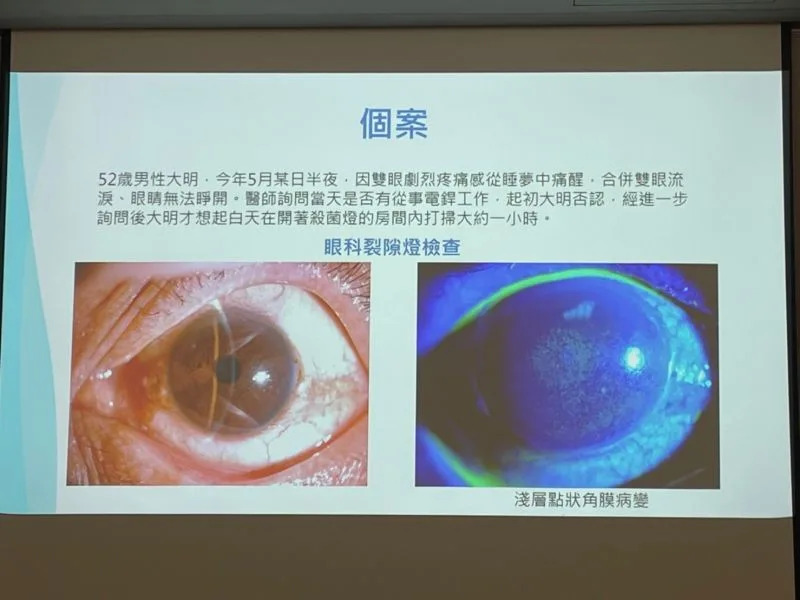 ▲光照性角結膜炎為紫外光造成的角結膜傷害，通常會出現雙眼結膜紅腫(左)、角膜出現散布性點狀病灶(右)（圖／記者林怡孜攝，2022,11,18）