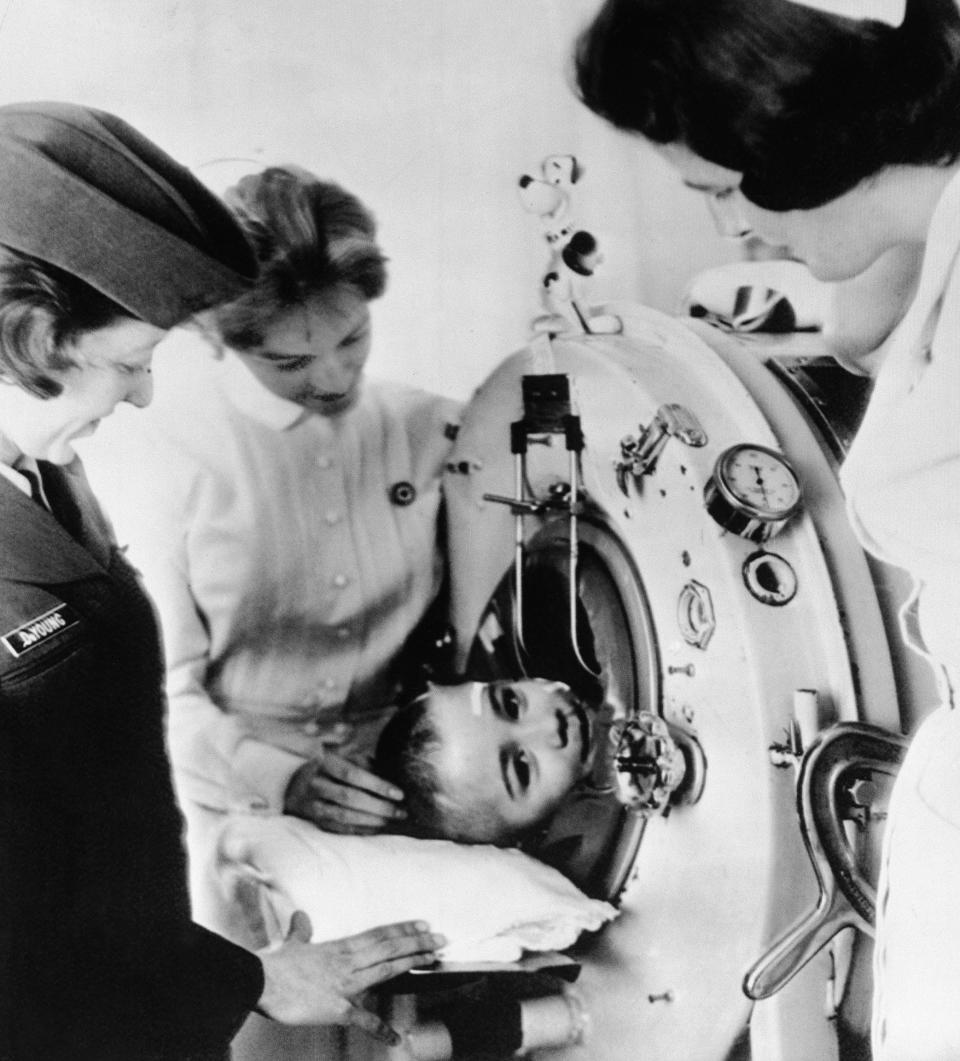 In February 1961, 6-year-old Johnny Whetzel of Bergton, Va., left his iron lung at the University of Virginia Hospital, where nurses Beverly Archer, center, and Peggy Moore, right, had cared for him during five months of treatment for polio in Charlottesville, Va.