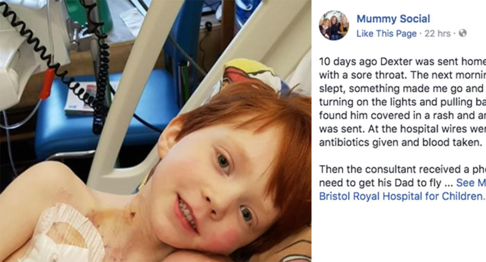 Barron, a mother of three, found her 4-year-old son Dexter covered in a rash after he was sent home from school. She had a hunch something wasn’t right, and he was rushed to the hospital by ambulance. (Photo: Facebook/Mummy Social)