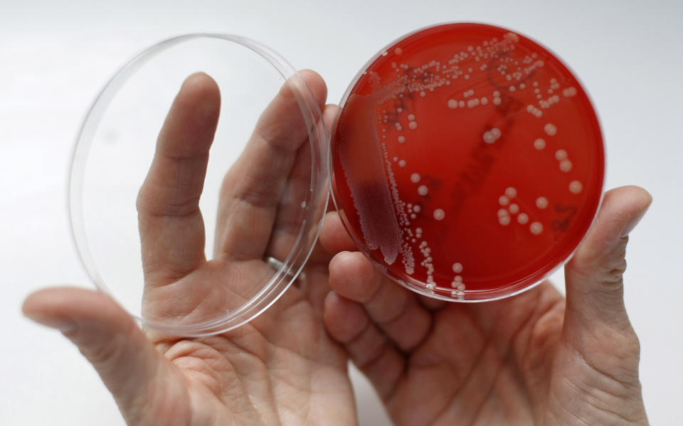 Una muestra de estafilococo dorado, resistente a los antibióticos, en una caja petri en un laboratorio de microbiología en Alemania,(Reuters)