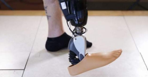 Toe Prosthesis  Milwaukee — Life-like Prosthetics