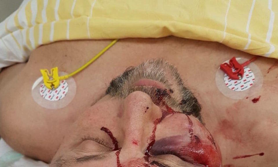 The Alternative for Germany party released this image of Frank Magnitz in hospital (Picture: AfD)