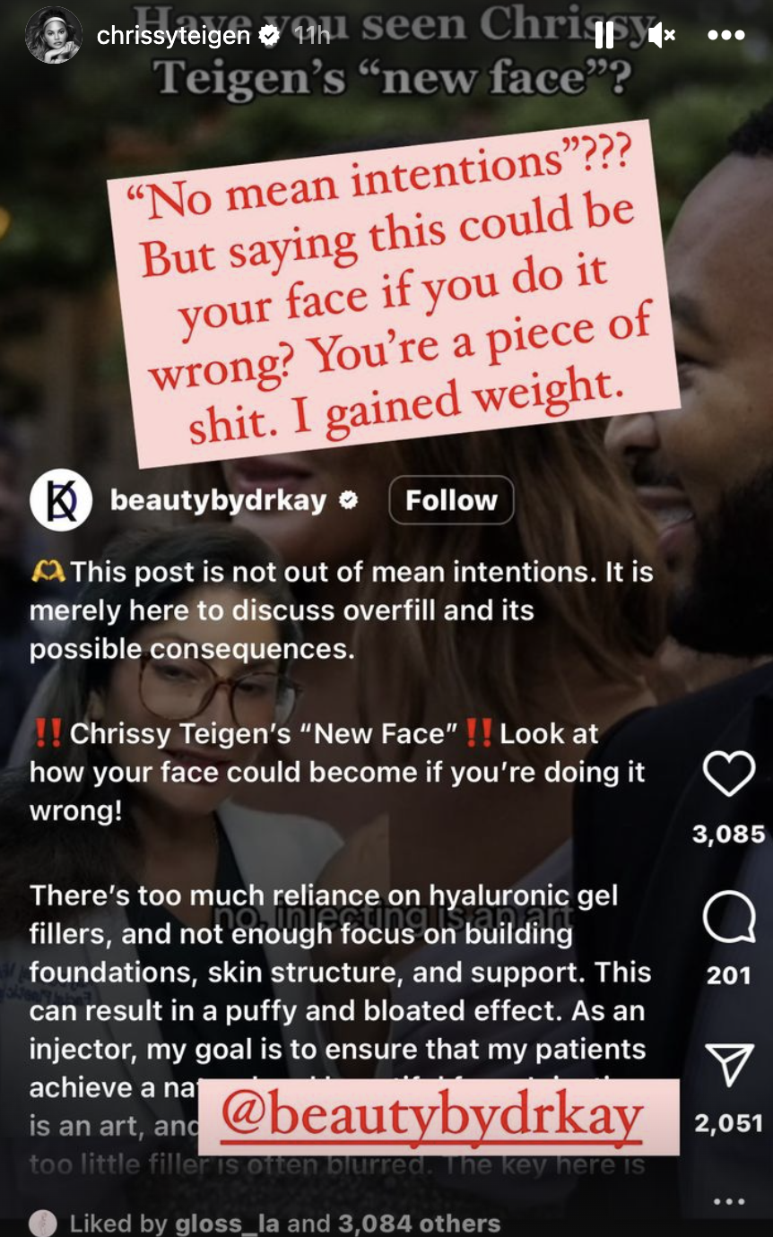 Chrissy responds to post critiquing her "puffy and bloated" face and saying "This post is not out of mean intentions" by saying "'No mean intentions?' But saying this could be your face if you do it wrong? You're a piece of shit; I gained weight"