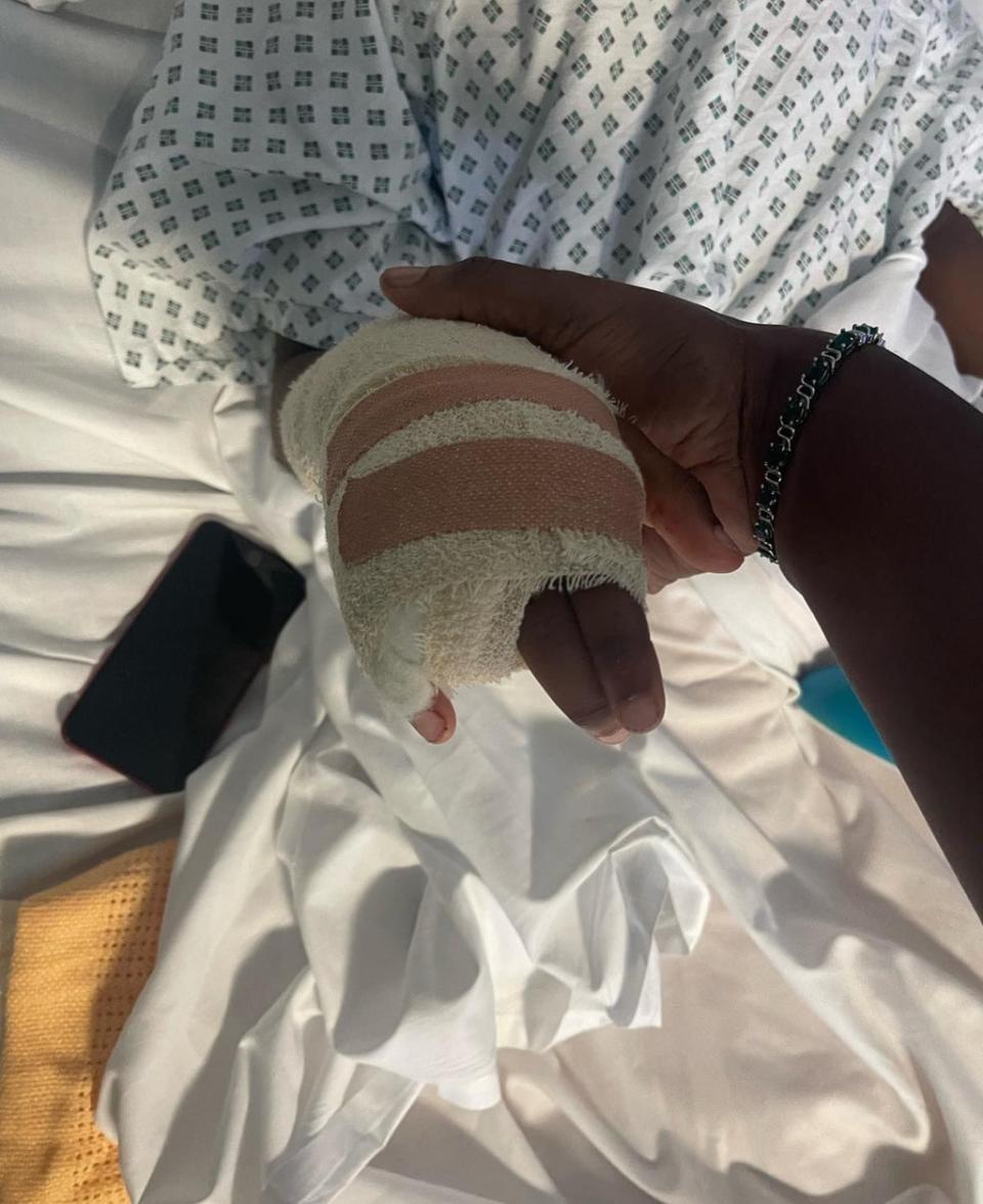 Raheem Bailey, 11, who had his finger amputated after he injured it (Family handout/PA) (PA Media)