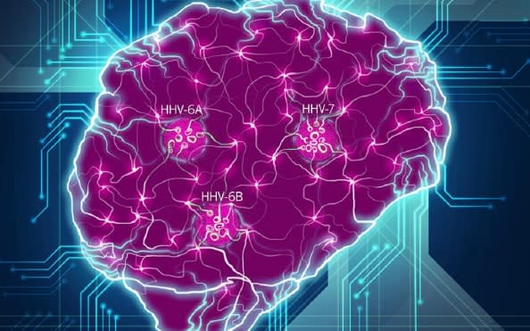 Researchers found large amounts of viral DNA in key areas of the brains of Alzheimer's patients  - Redhead et al