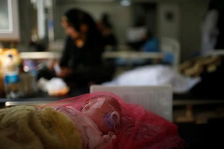 An Iraqi child lies in a bed at a hospital run by Medecins Sans Frontieres (MSF) in Qayyara, Iraq April 6, 2017. Picture taken April 6, 2017. REUTERS/Suhaib Salem