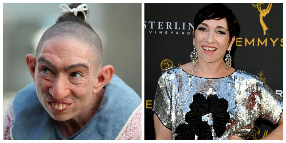 <p>Naomi Grossman does an incredible job playing Pepper, a woman with microcephaly, on <em>American Horror Story</em>. Grossman, who does not have this medical condition in reality, is another celebrity who must spend hours in the makeup chair to achieve this look. </p>