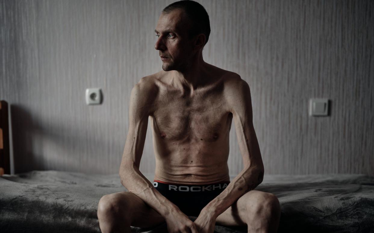A Ukrainian prisoner of war sits