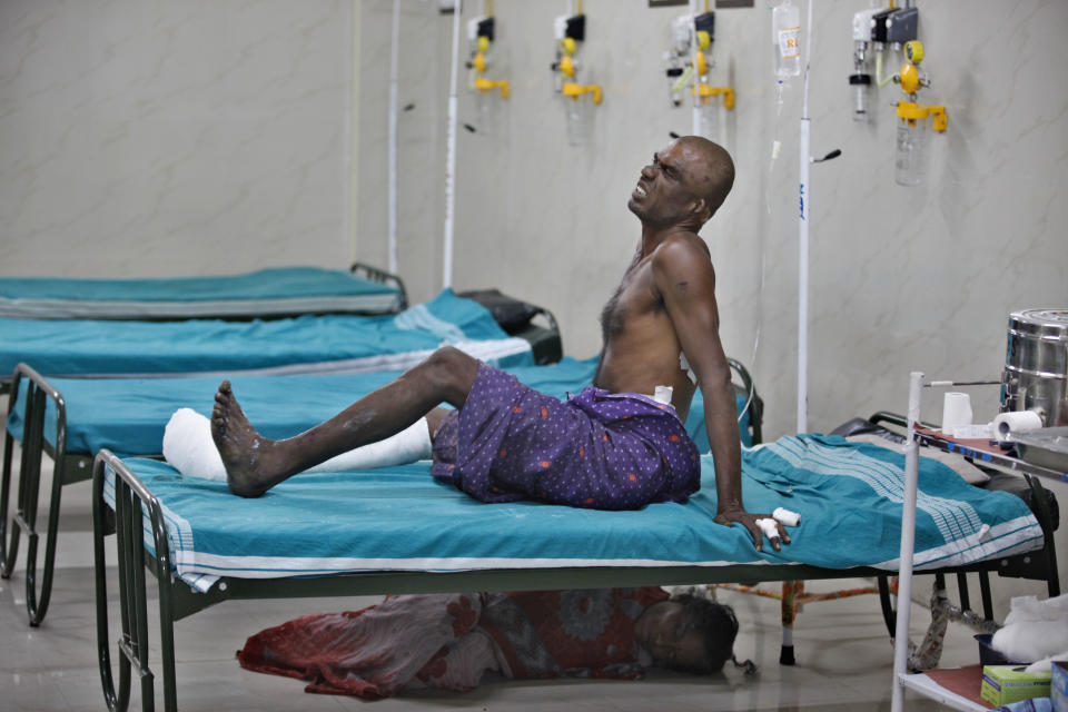 K. Arjunnan, injured with burns on his legs and hands grimaces in pain as his relative sleeps under the bed at a government run hospital in Madurai, about 460 kilometers (285 miles) southwest of Chennai, India, Thursday, Sept. 6, 2012. A massive blaze raged for hours at a fireworks factory in southern India, killing at least 40 workers and injuring 60 Wednesday, police said. Large amounts of firecrackers and raw materials had been stored in the Om Siva Shakti factory with major Hindu festivals weeks away. (AP Photo/Aijaz Rahi)