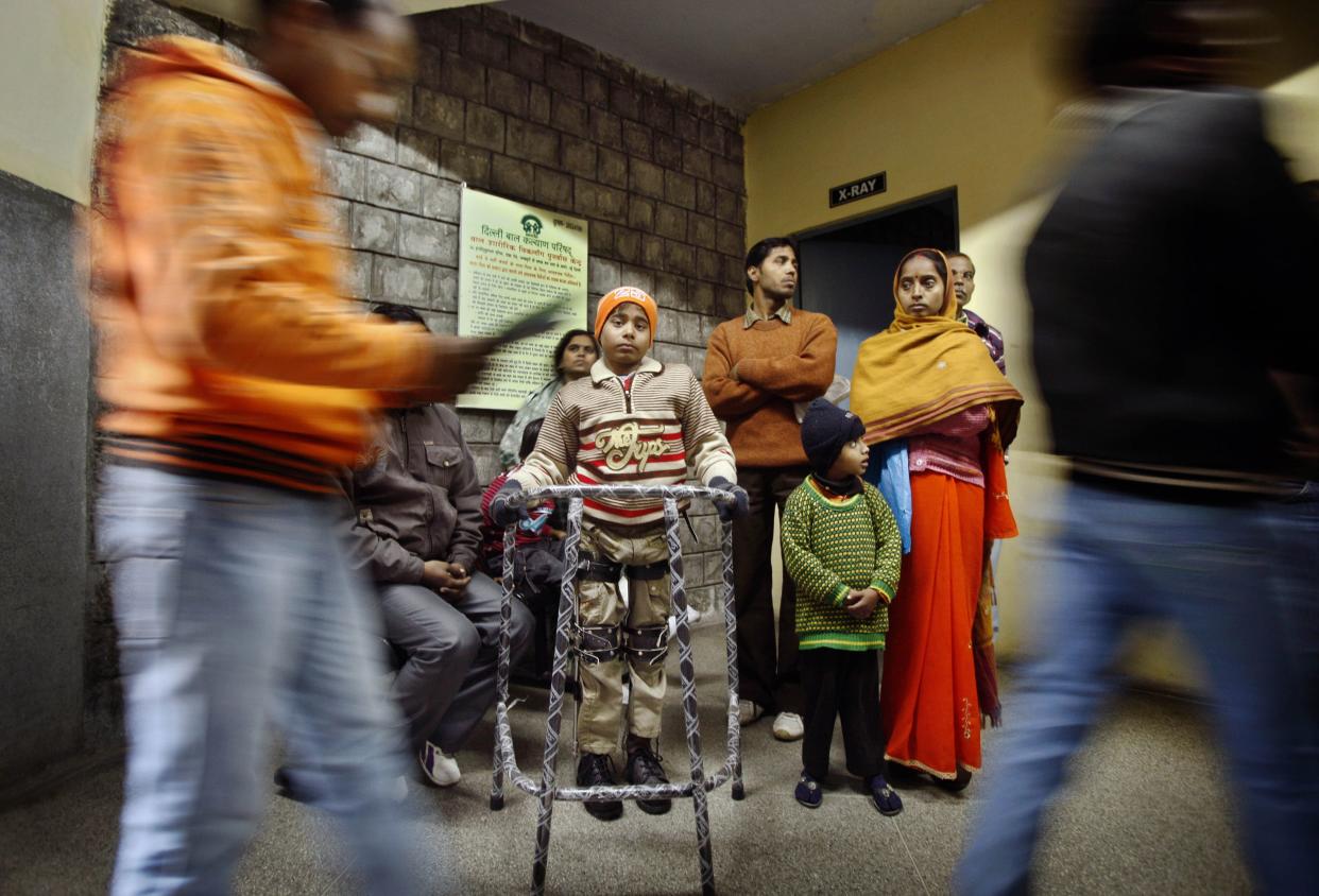 In this Wednesday, Jan. 11, 2012 photo, polio affected Mohammed Fazil waits for treatment at an out patient department clinic run by non-government organization Delhi Council for Child Welfare in New Delhi, India. 