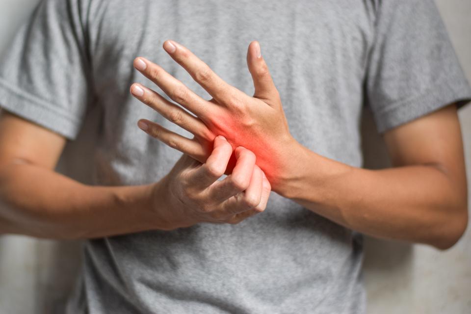 Asian young man scratching his hand. Concept of itchy skin diseases such as scabies, fungal infection, eczema, psoriasis, rash, allergy, etc.