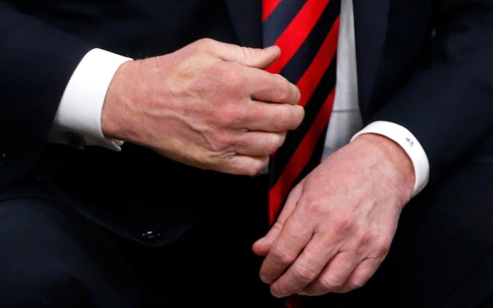 The imprint of French President Emmanuel Macron's thumb can be seen across the back of President Trump's hand after a handshake during a bilateral meeting at the G7 Summit in Canada on June 8, 2018.