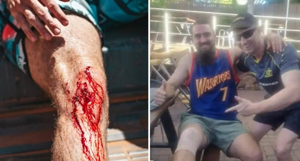 A man in WA was bitten by a croc while walking with his friends near a popular camping spot. Source: 9 News