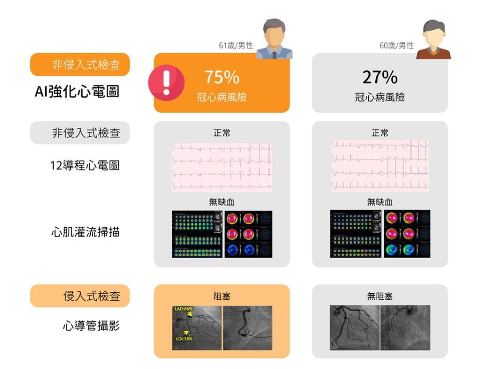 AI預測系統