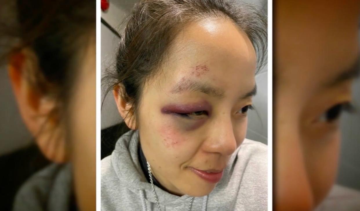 <p>Asian woman dragged by car in San Francisco in latest shocking attack</p> (ABC7)