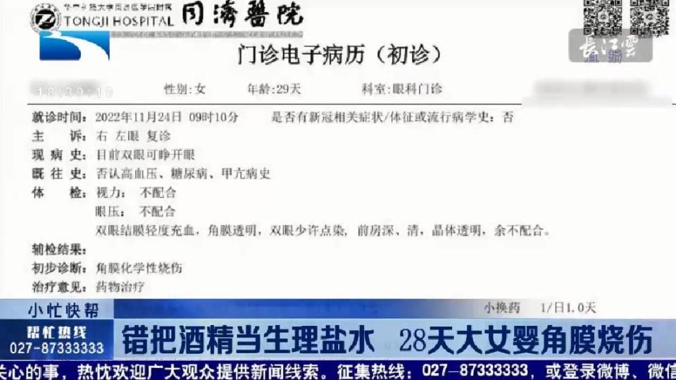 院方診斷女嬰出現雙眼角膜化學性燒傷。（圖／翻攝自微博）