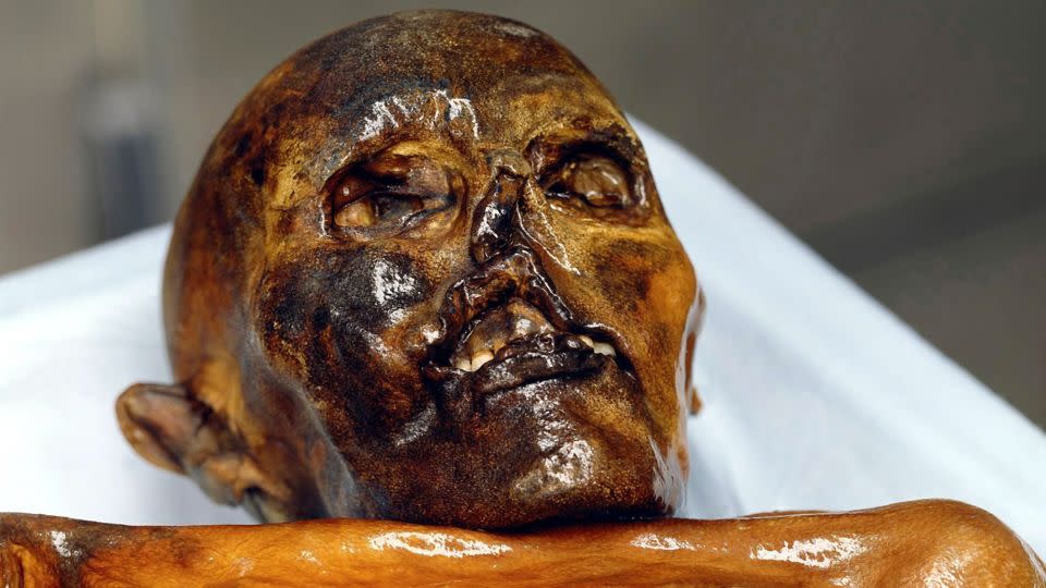 Audiobook of Ötzi's 5,300-year-old frozen corpse in the Archaeological Museum in Bolzano.  - Südtiroler Museum/picture alliance/dpa/AP