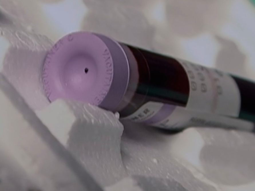 Steven avery blood vial making a murderer netflix