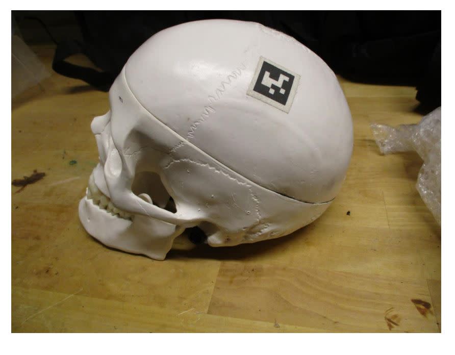 A “suspicious” skull found in checked luggage at Salt Lake International Airport (Courtesy of TSA)