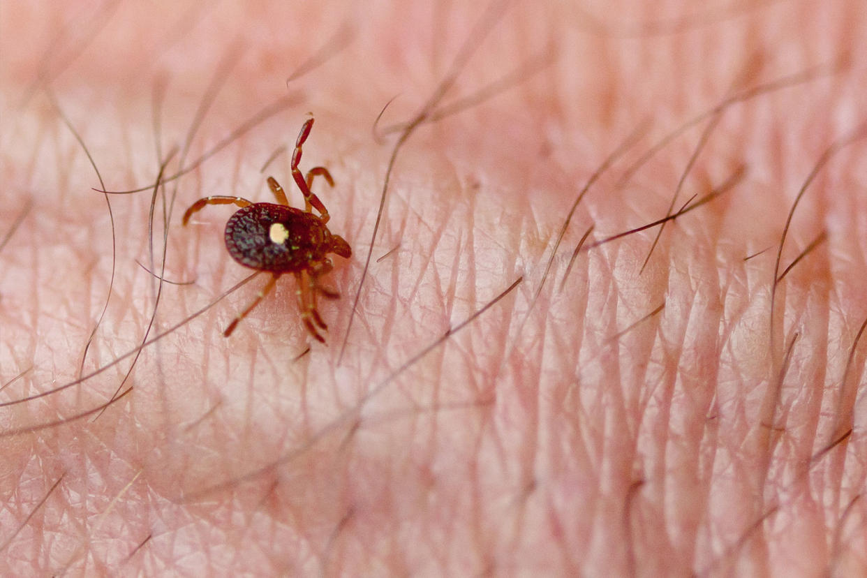 Lone Star Tick (Amblyomma americanum) on human skin Getty Images/epantha