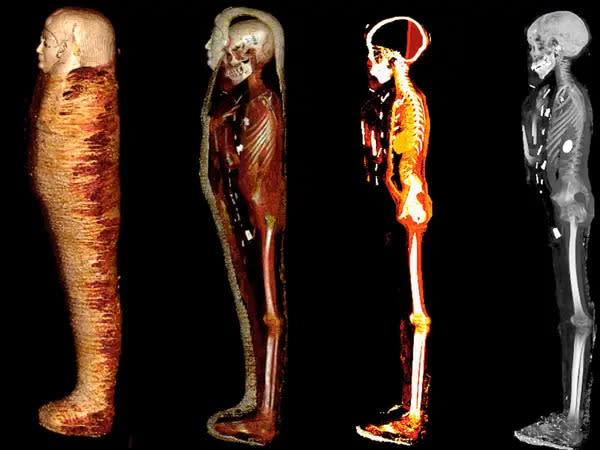 Mit Hilfe eines CT-Scan können Wissenschaftler Mumien digital sezieren, ohne sie zu beschädigen. - Copyright: Sahar Saleem