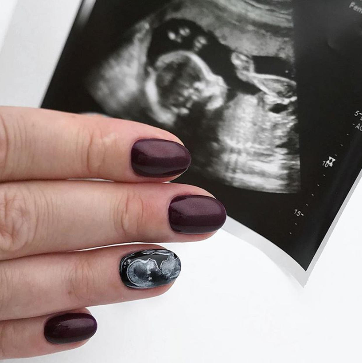 Ungeborene Babys auf den Fingernägeln: Machen oder sein lassen? (Bild: instagram/euro_nails_tx)