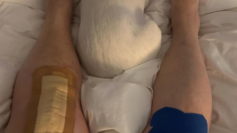 Dawn French legs lying on bed with pet dog after knee operation 