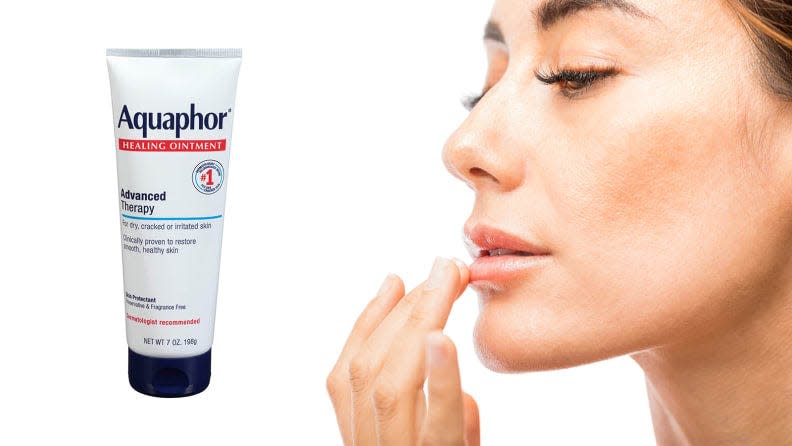 Aquaphor is a must-have for everyone.