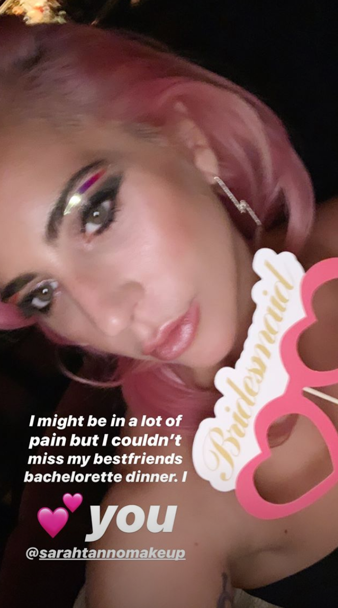 Lady Gaga shared on Instagram Stories that she’s “in pain” following her viral fall.