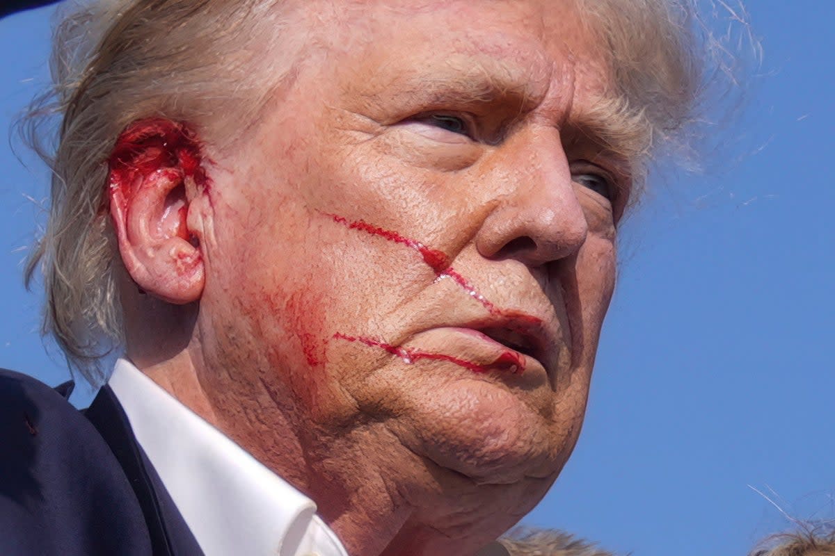 Donald Trump is seen with a bloody face after surviving an assassination attempt at a rally in Pennsylvania (AP)