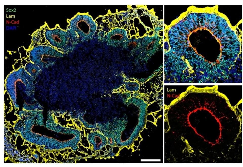 <div class="inline-image__caption"><p>Using specific biomarkers, it is possible to observe structural details of organoids (yellow and red) as well as all the organoid cells in blue and green.</p></div> <div class="inline-image__credit">Gaia Novarino</div>