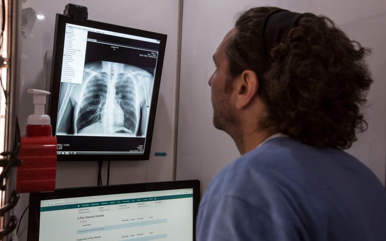 A radiographer looks at an X ray of a diseased lung - Jeff Gilbert