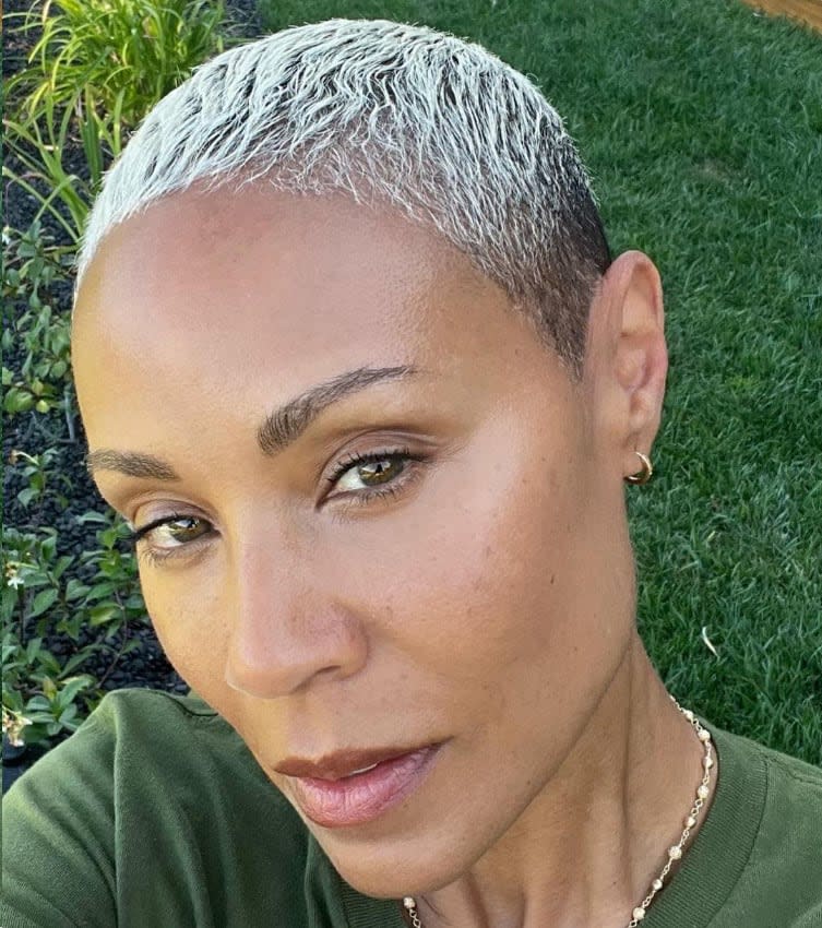 Jada Pinkett Smith ha mostrado su mejora en la alopecia que sufre