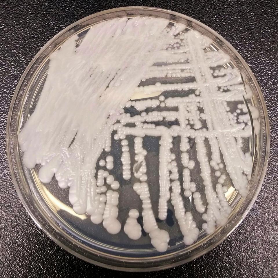 Superbug Fungus (ASSOCIATED PRESS)